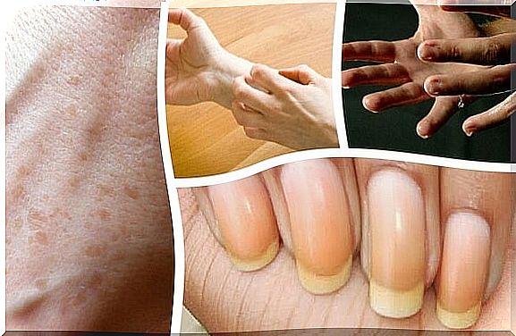 9 interesting things your hands reflect on your health