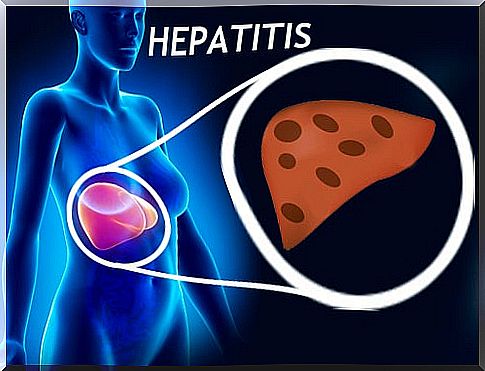 Are there natural remedies for hepatitis?