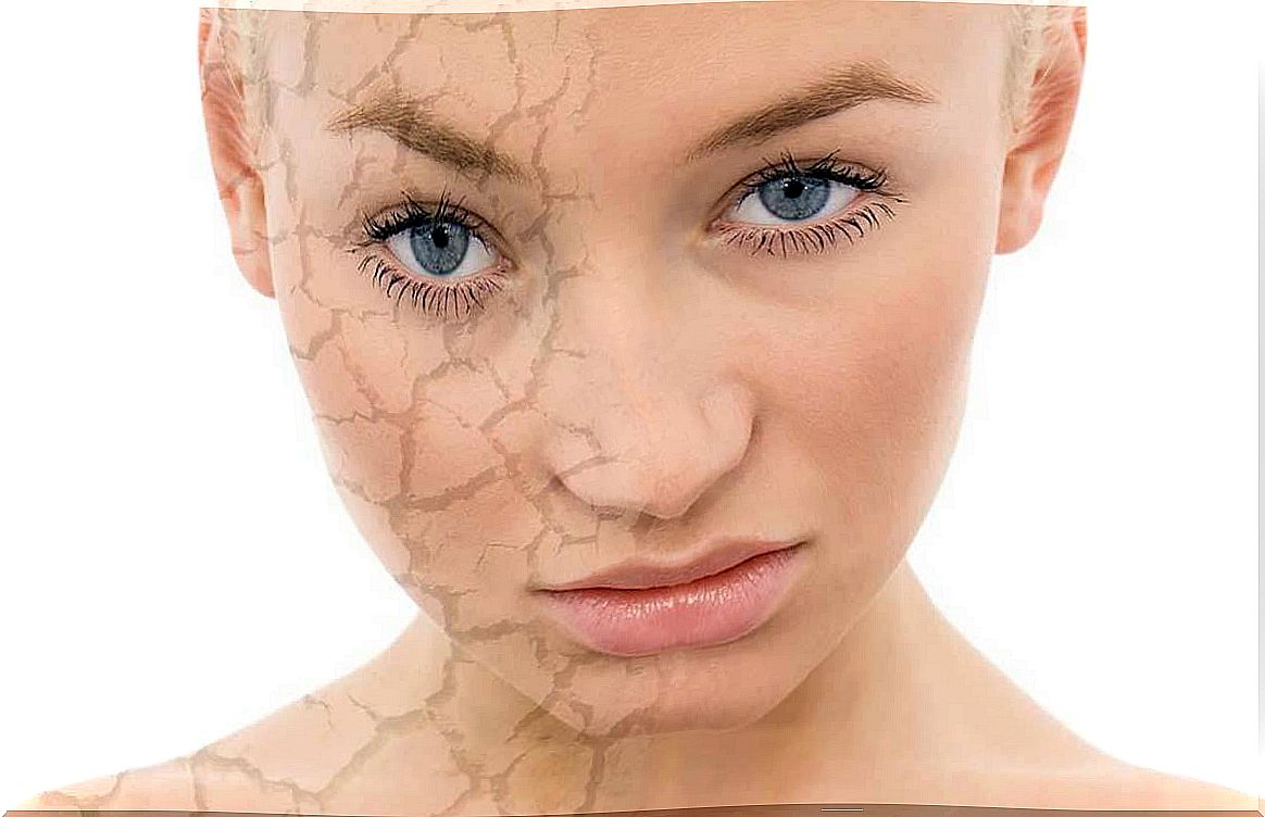 Foods and supplements for dry, dull skin