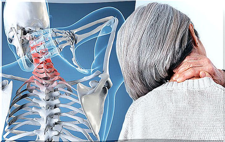 Cervical osteoarthritis