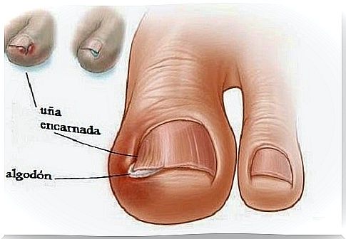 Toe problems