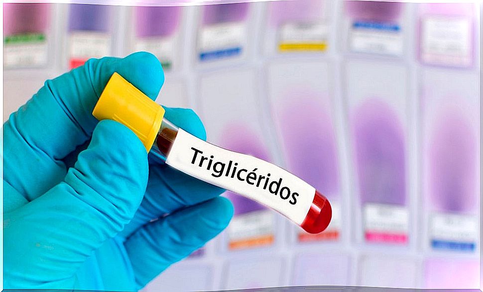 triglycerides