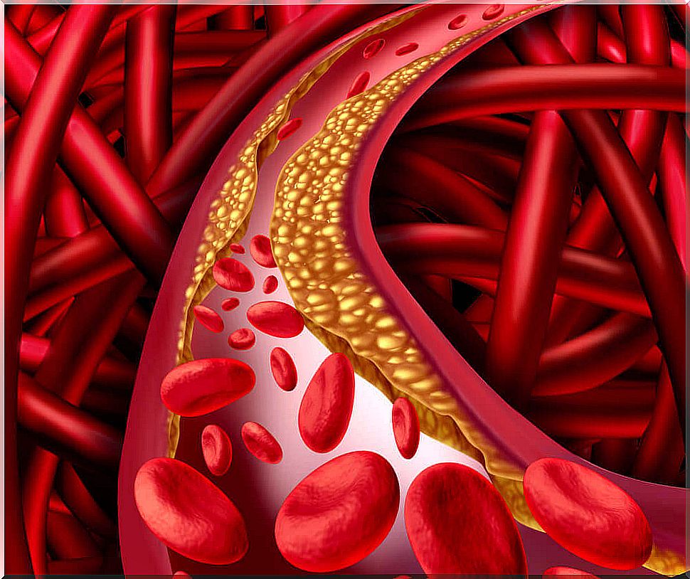 Cholesterol levels